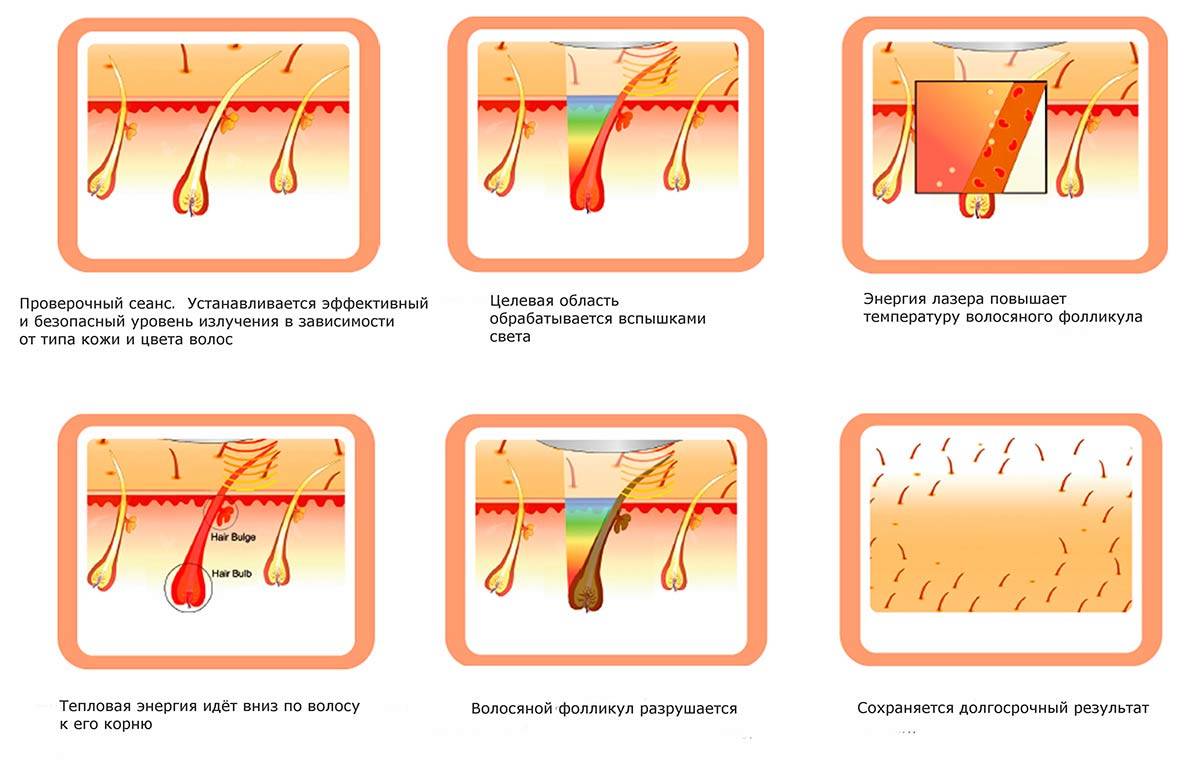 Ботокс для лица - плюсы и минусы процедуры, отзывы, противопоказания к уколам ботокса